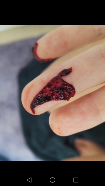 is this a miscarriage? *graphic*