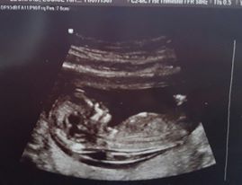 Boy or girl? Nub theory? :D