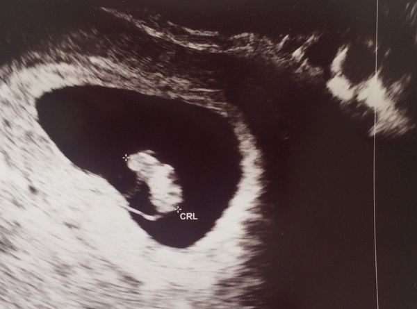 March 2017 - Thread #2