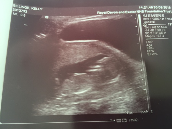 Girl or Boy... Guesses for fun
