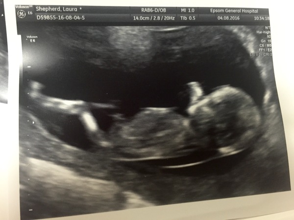 Due in February 2017....thread 5!