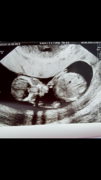 Due in February 2017....thread 5!