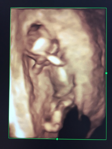 Due in February 2017....thread 5!