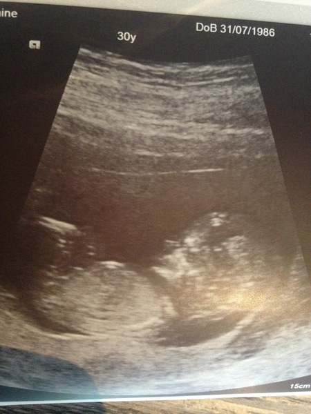 Due in March 2017 - thread #4