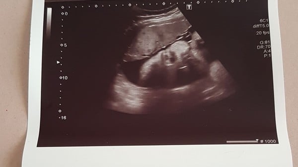 Thread #10 - TTC#1 Grads Thread - Babies Ahoy