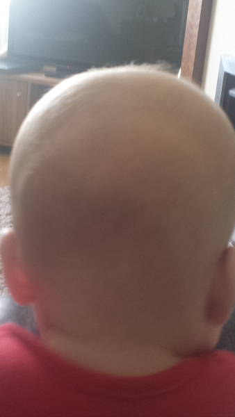 Is this normal?