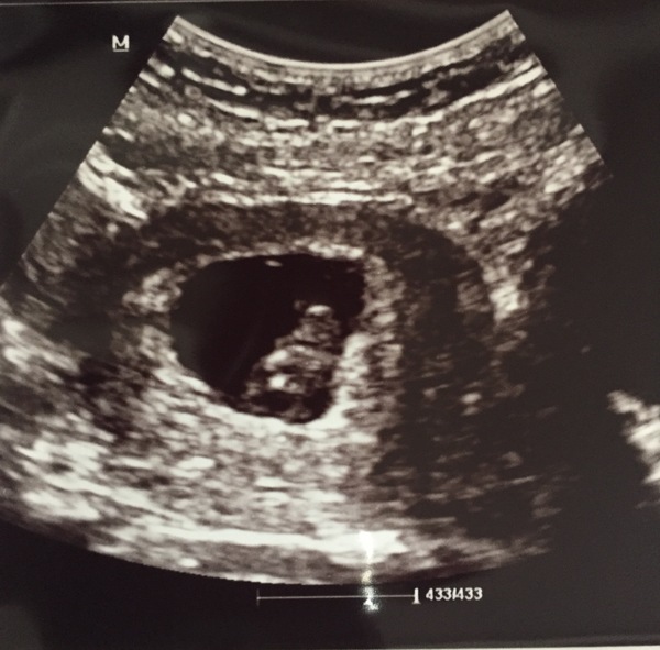 April 2017 #2 - come join us, we promise not to throw up on you (hopefully!)