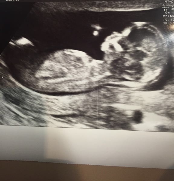 Due in February 2017....thread 5!