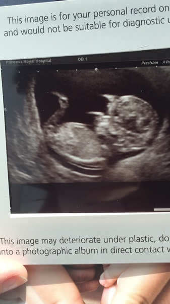 Due in February 2017....thread 5!