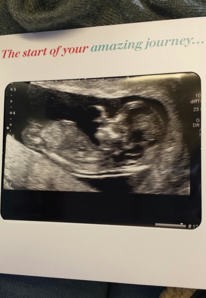 Due February 2017- thread #6