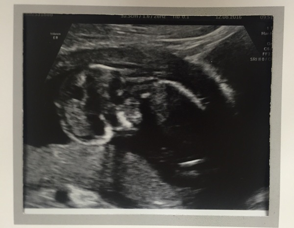 Due in February 2017....thread 5!