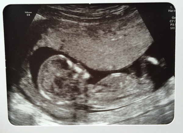 Due in March 2017 - thread #3