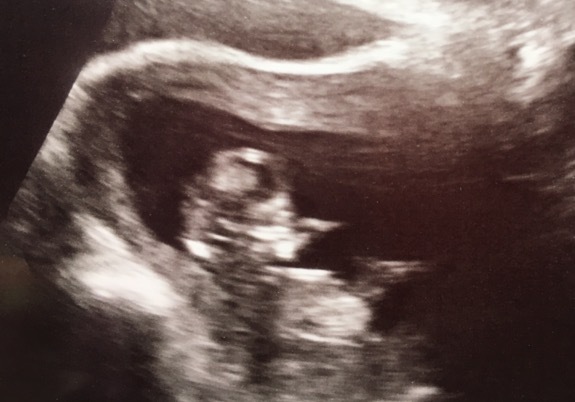 Due in March 2017 - thread #3