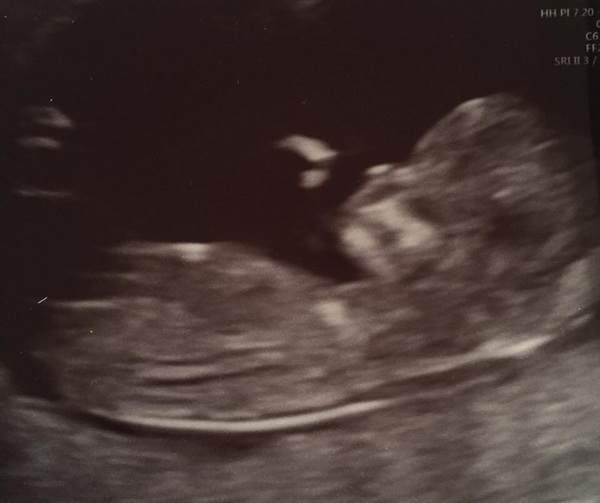 Due in February 2017....thread 5!