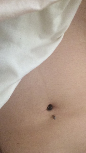 Black line down belly??