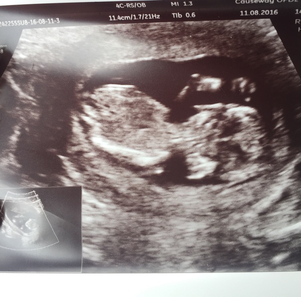 Due in February 2017....thread 5!