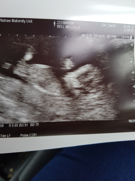 Due in February 2017....thread 5!