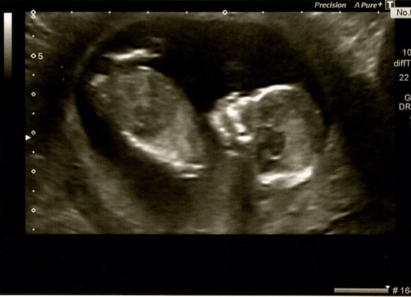 Scan pic? What gender is my baby..