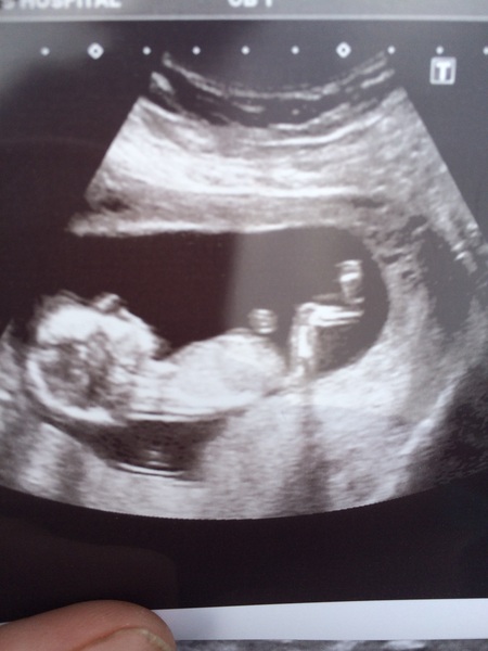 Due in February 2017....thread 5!