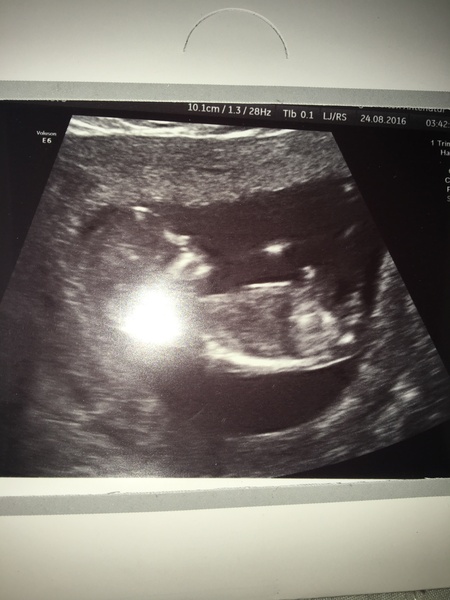Gender guesses please :)!