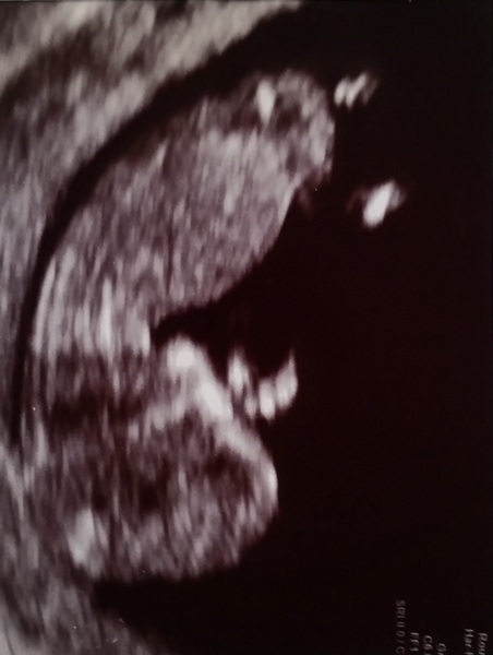 Due in February 2017....thread 5!