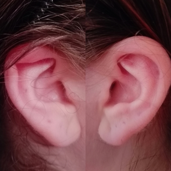If you had this physical 'quirk' would you try and rectify it? AIBU and superficial?