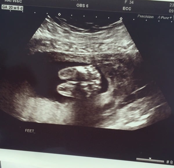 Thread #10 - TTC#1 Grads Thread - Babies Ahoy