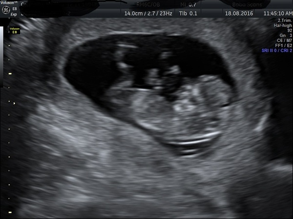 Gender guesses please :)!