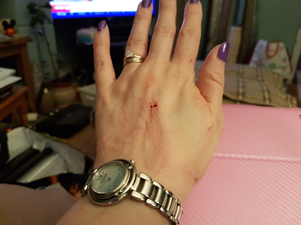 Ouch!