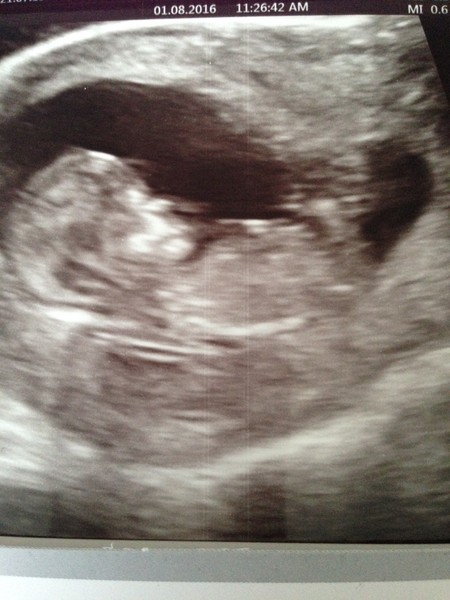 Due in February 2017....thread 5!