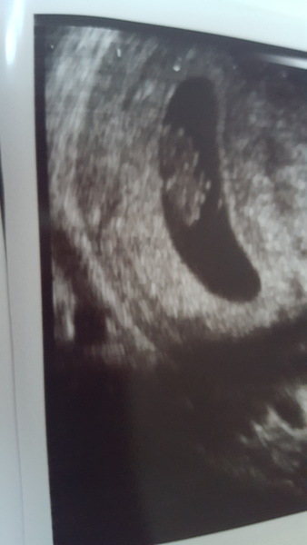 Due in March 2017 - thread #3