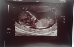 Boy or girl? Nub theory!