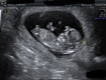 Gender guesses please :)!