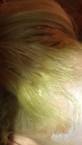 Hairdresser burnt scalp banana roots