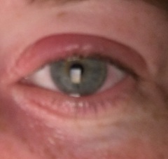 Is this a Stye? Pics in thread