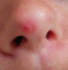 What's this on nose tip?  Pics included!