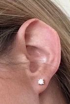 If you had this physical 'quirk' would you try and rectify it? AIBU and superficial?