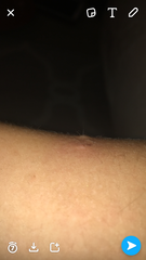 Mole(pictures)