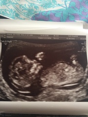 Due in February 2017....thread 5!