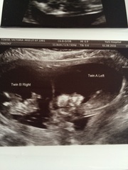 Due in February 2017....thread 5!