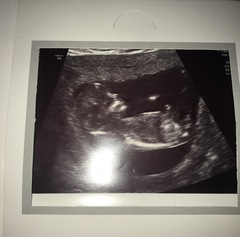 Gender guesses please :)!