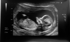 Boy or girl? Nub theory!