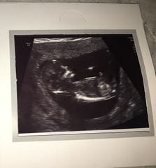 Gender guesses please :)!