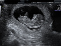 Gender guesses please :)!