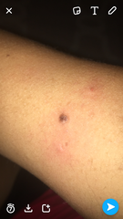 Mole(pictures)