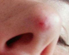 What's this on nose tip?  Pics included!