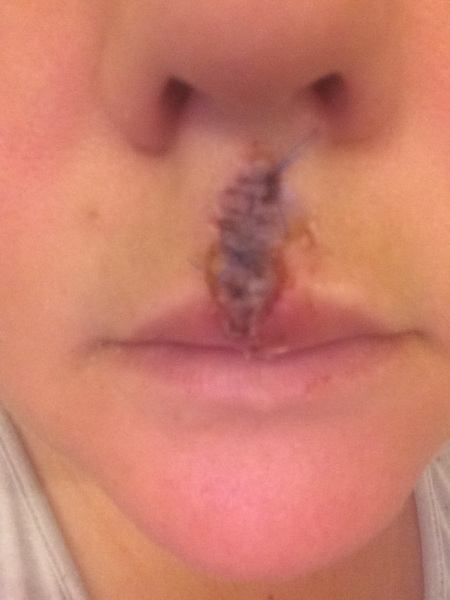 what is this on my face??? (pic attached)