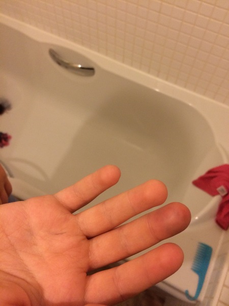 To not take DS to A&E