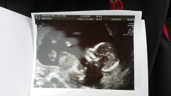 Due in March 2017 - thread #4