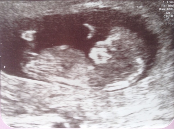 Due in March 2017 - thread #4